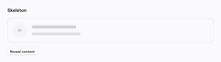 Skeleton rendered by native SwiftUI.